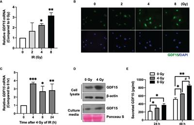 Ionizing Radiation-Induced GDF15 Promotes Angiogenesis in Human Glioblastoma Models by Promoting VEGFA Expression Through p-MAPK1/SP1 Signaling